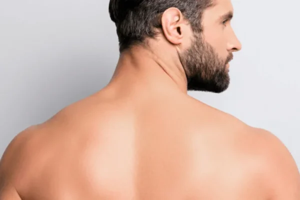Men back shoulder laser hair removal