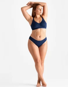 abdomen laser hair removal treatment