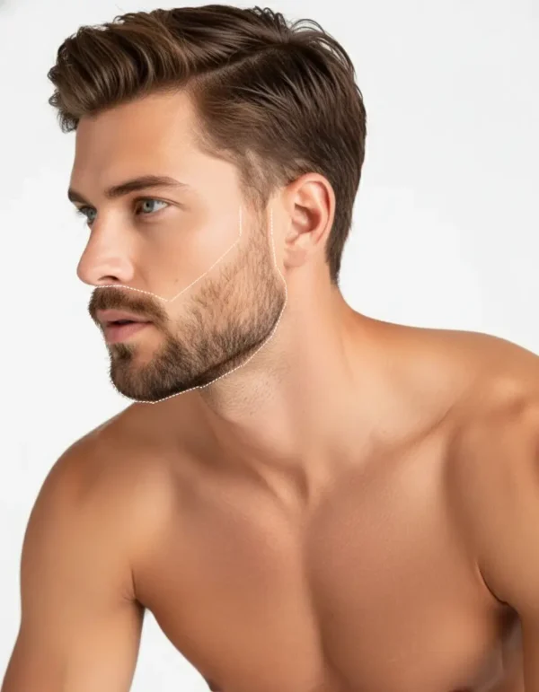 Laser Beard Sculpt Laser Hair Removal Male Face Man with a neatly Laser Beard sculpt laser hair removal smooth skin on the cheekbones and front of the neck after laser hair removal