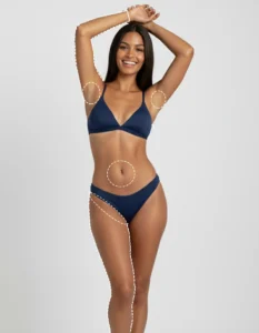 Female showing laser hair removal treatment areas on her body