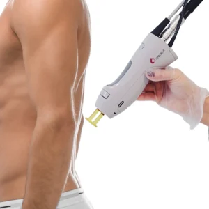 Man having upper body torso laser hair removal treatment in a professional laser perfect, laser-clinic technician using a laser device on the back, shoulders, chest and stomach area.