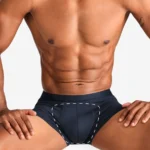 Bikini Line - Laser Hair Removal