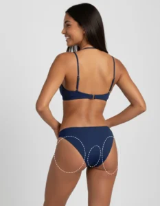 Perianal and bum laser hair removal treatment at Laser Perfect clinic, showing a discreet, professional approach to intimate hair reduction.