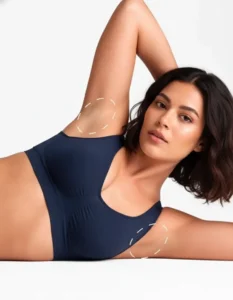 underarm laser hair removal treatment