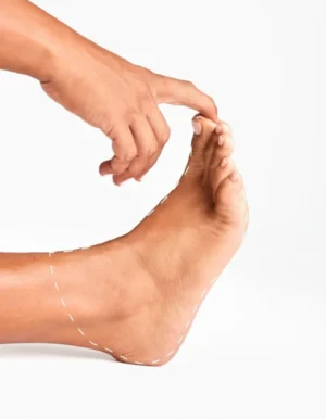 feet laser hair removal treatment