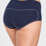 Buttocks laser hair removal in Ilford at Laser Perfect for smoother skin and long-lasting reduction of unwanted hair.