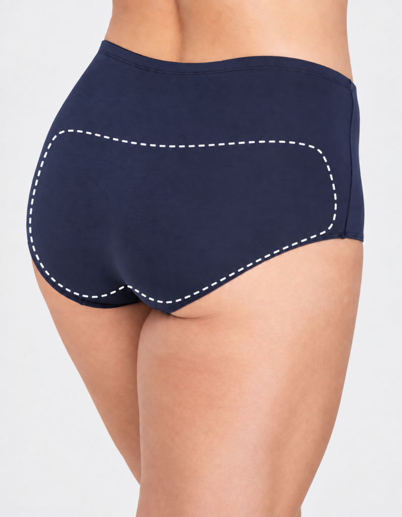 Buttocks laser hair removal in Ilford at Laser Perfect for smoother skin and long-lasting reduction of unwanted hair.