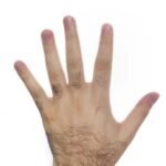 Men's Hands Laser Hair Removal