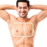 Professional Male Chest Laser Hair Removal treatment for long-lasting hair reduction and smooth, confident skin