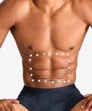 Male Abdomen Laser Hair Removal | Laser Perfect Ilford Professional Male Abdomen Laser Hair Removal treatment for long-lasting hair reduction and smoother, confident skin.