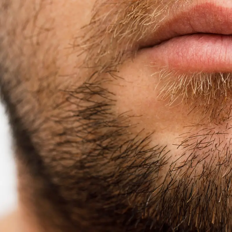 Male beard requirig reduction
