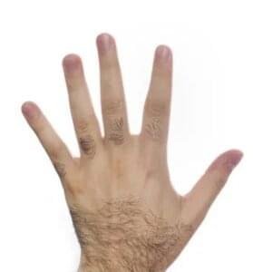 Home Men laser hair removal at Laser Perfect laser clinic in Ilford London