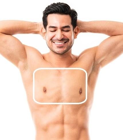 Professional Male Chest Laser Hair Removal treatment for long-lasting hair reduction and smooth, confident skin