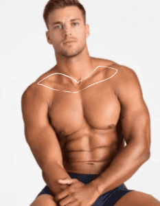 Men Collarbones laser hair removal at Laser Perfect - laser hair - clinic Ilford, London