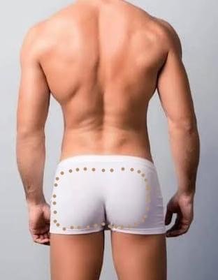 Male buttocks Laser Hair Removal | Laser Perfect Ilford Professional Male buttocks Laser Hair Removal treatment for long-lasting hair reduction and improved hygiene.
