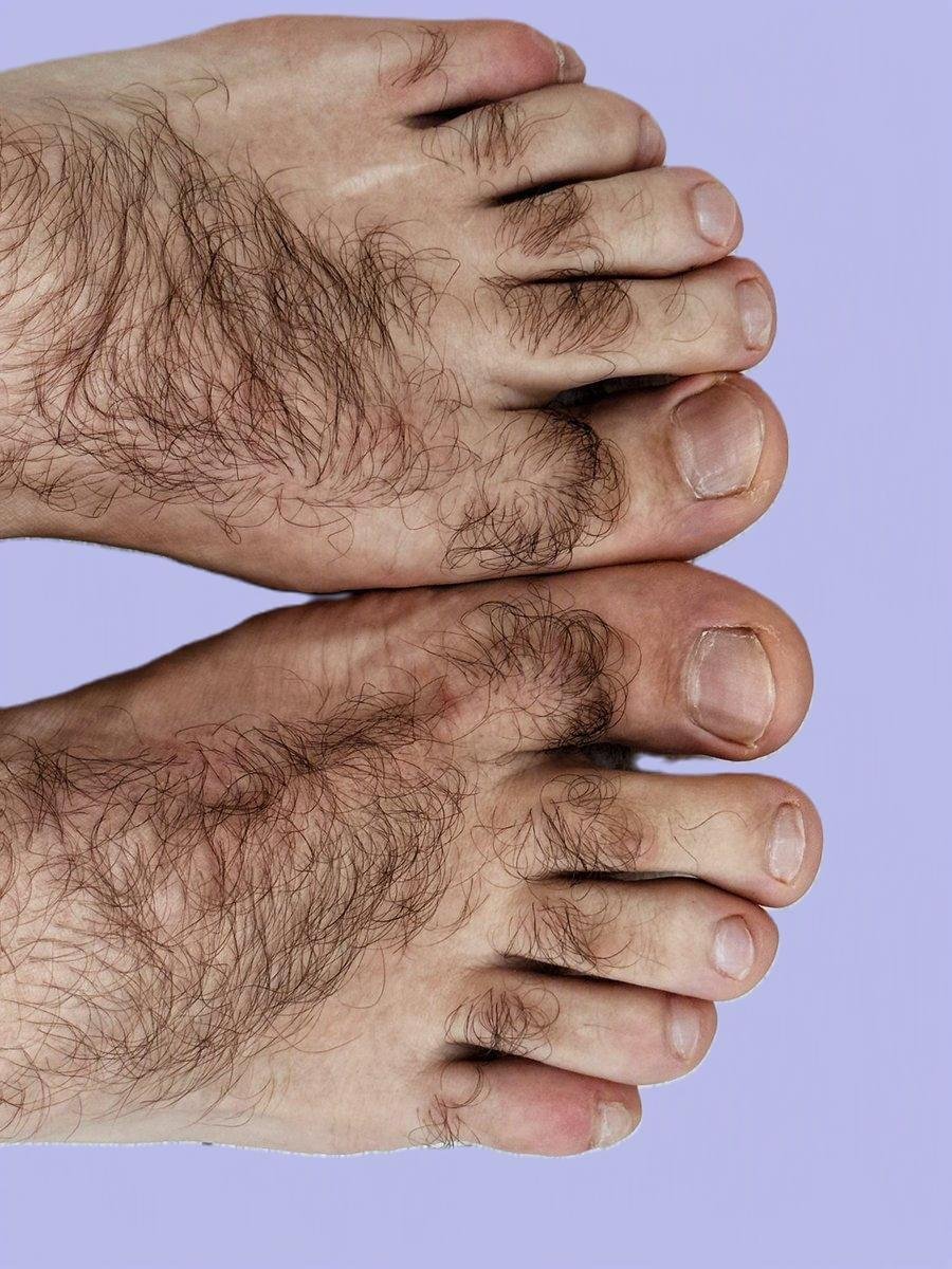 feet and toes laser hair removal Feet and toes laser hair removal